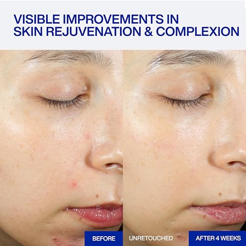 Image of IOPE Expert PDRN Caffeine Shot Serum - Anti-Aging Face Serum to Visibly Depuff, Smooth, and Rejuvenate Tired Skin - With BIO-PDRN and Caffeine - Fast-Absorbing Texture - 1.01 fl. oz.