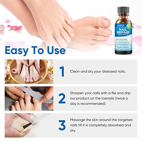 Nail Repair, Nail Repair For Damaged Nails, Renew Cracked & Discolored Toenail, Natural Solution For Nail Problems And Relieving Nail Pain #TOP3