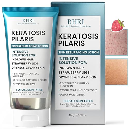 Keratosis Pilaris Treatment | Keratosis Pilaris Lotion with 10% AHA | Gentle Exfoliation For...