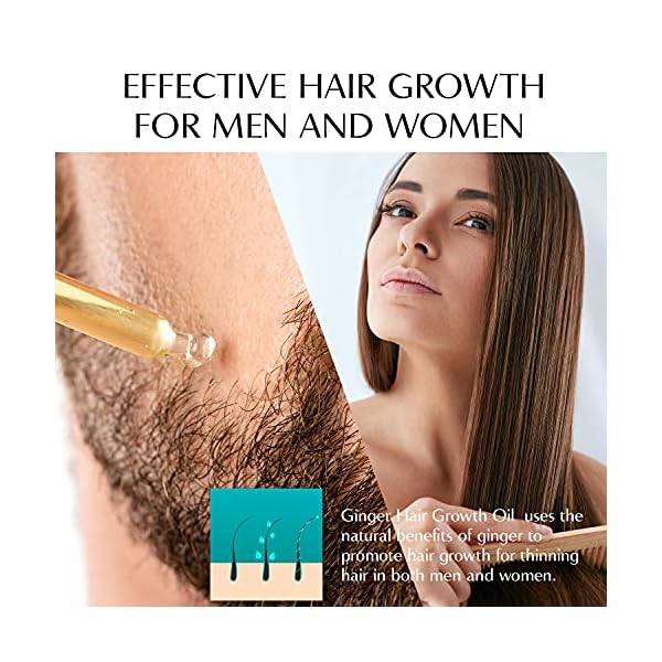 VigorWell Hair Growth Serum Ginger Hair Growth Oil Ginger Prevent Hair Loss and Natural Serum for Thicker, Stronger…