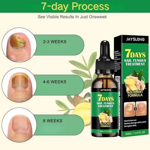 Ginger Nail Serum Solution, Ginger Cuticle Care Oil for Nails (2 PCS) - Image 3