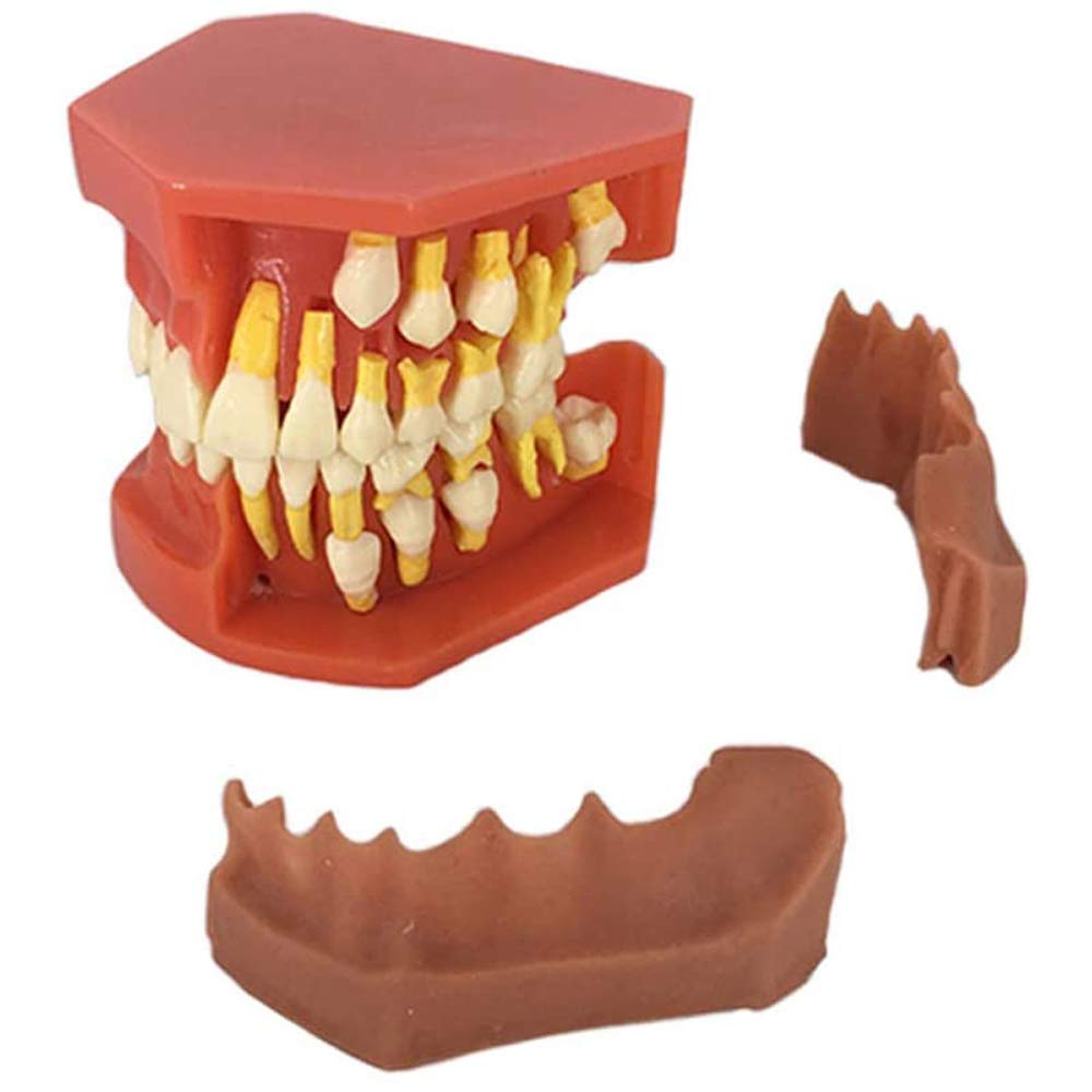 Oral Cavity Deciduous Tooth Replacement Model, Dental Children Removable Deciduous Teeth Model Permanent Tooth Alternative Display Studying Teaching Tool