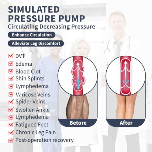 Image of ABIRAM Anti Embolism Stockings Thigh High 15-20 MmHg with Inspection Hole