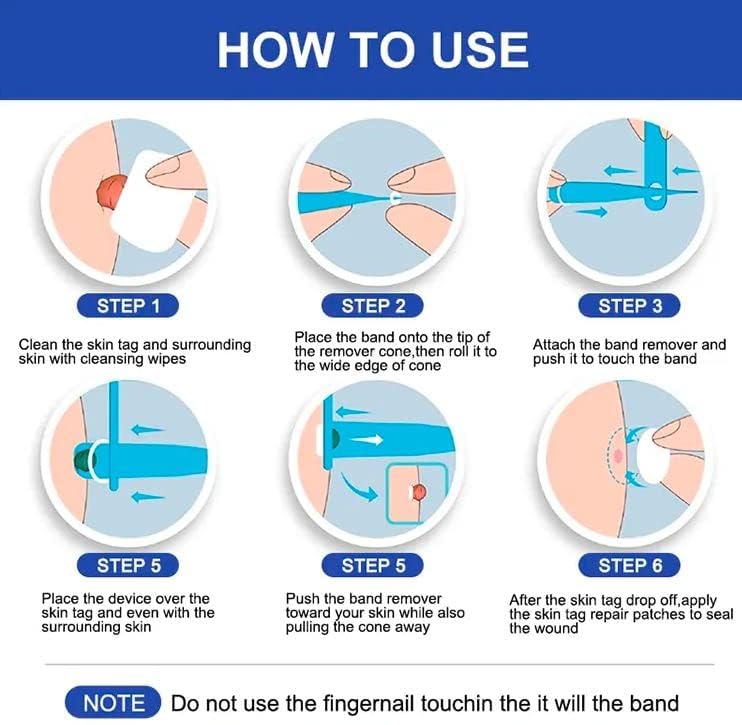 Image of Skin Tag Remover Set, Skin Tag Remover Kit 2 in 1, Skin Tag Removal Kit with Rubber Bands Rings for Removing Small to Medium