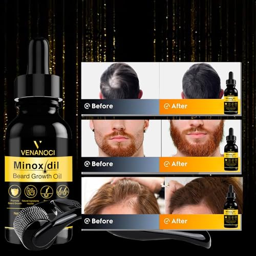 Hair Oil for Hair Growth: Hair Growth Serum for Scalp Hair Loss & Thinning - Hair Regrowth Treatment for Thicker, Longer, Fuller, Healthier Hair and Beard for Women and Men - Image 4