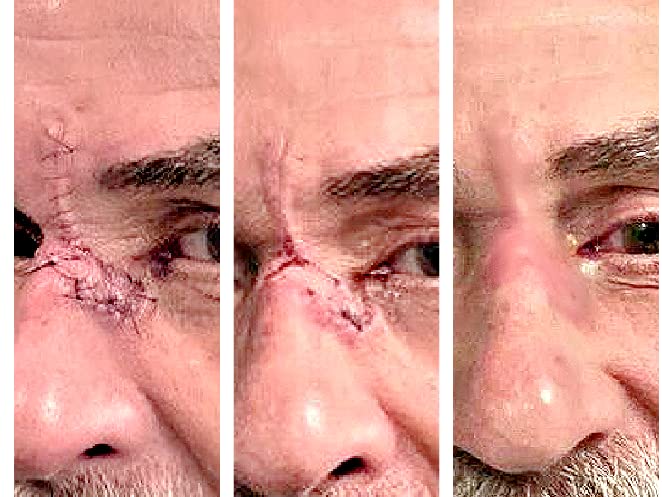 Miniatura 5 de Tamanu Multi Purpose  Cracked Skin  First Aid Ointment  Wounds  Scars Surgery Stitches Infection  Hemorrhoids Boils  Abscess  Fissures + Hemorrhoids