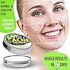 Cystic-Acne-Treatment-and-Acne-Scar-Remover-Made-in-USA-Effective-Face-Body-Severe-Acne-Cleanser-with-Tea-Tree-Oil-Prevent-Future-Breakouts-Natural-Acne-Spot-Pimple-Cream Wellution Cystic Acne Treatment Cream - Natural Pimple and Scar Remover with Tea Tree Oil - Effective Overnight Face Treatment for Acne Spots, Pimples and Scars - 1oz