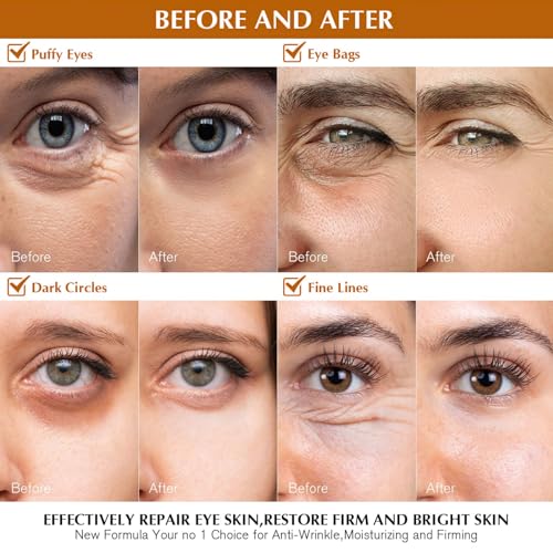 Snake Venom Eye Cream - Anti Wrinkle Eye Cream For Puffiness + Wrinkles, Brightening Under Eye Cream, Diminishing Deep Wrinkles Dark Circle Eye Cream, Eye Bag Treatment For Men And Women, 30g - Image 5