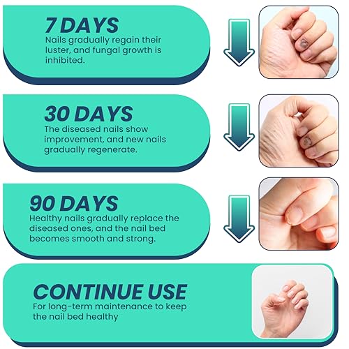 Extra Strength Nail Repair Pen – Restores Damaged, Thick or Discolored Nails with Natural Oils & Undecylenic Acid – Nail Support Formula – 2 Pack - Image 4