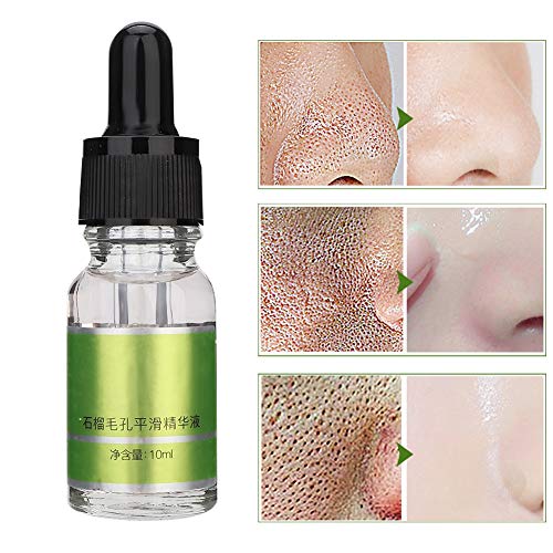 ANGGREK dei pori dei pori Riduzione del viso