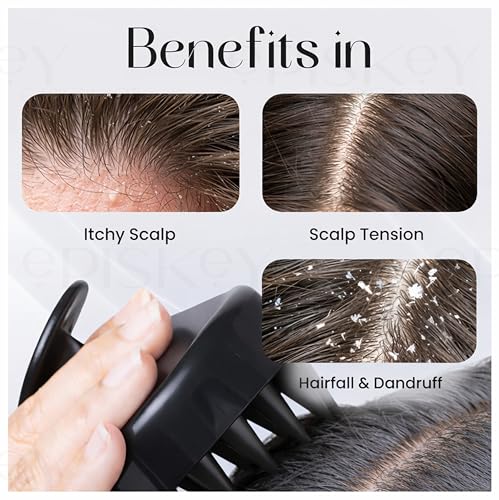 Image of Episkey Professional Derma Roller 0.5 mm with 540 Titanium Micro-Needles for Hair Growth, Beard Activation, Skin Rejuvenation (0.5 mm, Derma Roller) with Scalp Massager Brush for Hair & Shampoo | Relaxing Head Massager with Soft Silicone Bristles (black)