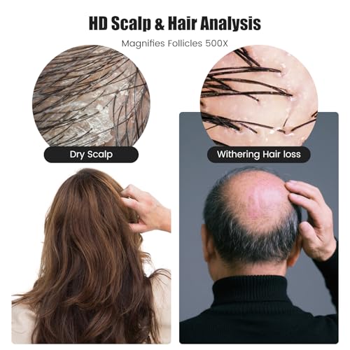 Image of Handheld Dermatoscope Skin Analyzer Machine, Wireless Portable Digital Microscope with 1080P IPS Screen 8 LEDs, 500X Magnifier, for Scalp /Hair Trichomes