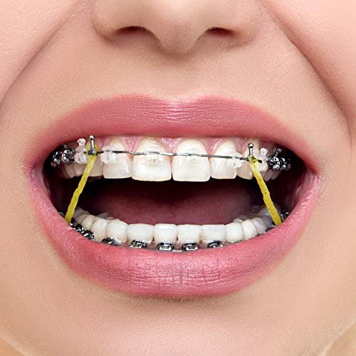 Image of JMU Orthodontic Elastics 1 /8 Heavy 6.5 oz 100 Pack Intraoral Elastic Bands Latex Dental Rubber Bands Made in USA