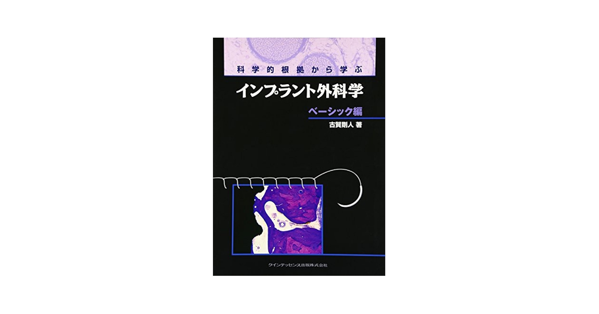 科学的根拠から学ぶインプラント外科学 応用編 科学的根拠から学ぶインプラント外科学 応用編 : Amazon.com.au