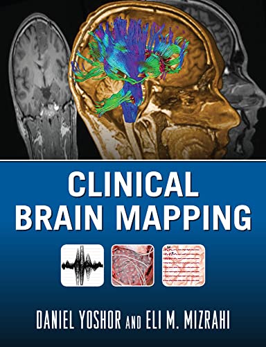 Clinical Brain Mapping view 2