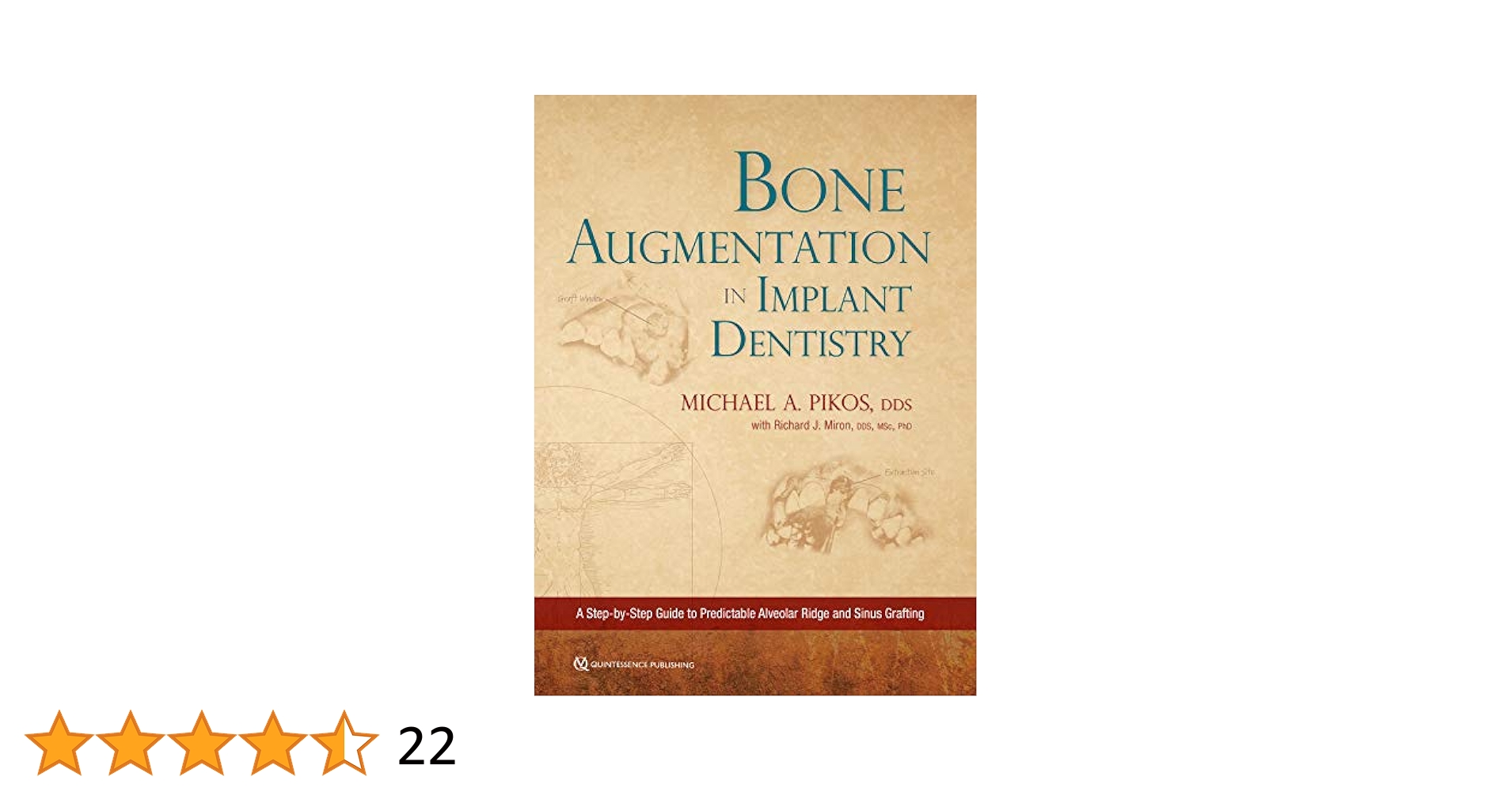 健康・医学 216 IMPLANTS Ultimate guide FREE PDF Zygoma Implants: Step by Step by Arun K. Garg by