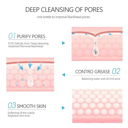 Salicylic Acid Face Mask Anti Acne Blackhead Facial Masks Oil Control Shrink Pores Skin Care Beauty Health #TOP4