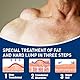 Lipom Entfernungscreme,Instant Lipoma Removal Cream,LumpFree Lipom Entfernung Creme,Herbal Lipoma Lumps Removal Cream,LumpFree Lipoma Removal Cream,Skin Anti Swelling Ointment,20g