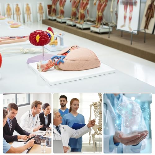 Modèle anatomique du foie pour expliquer les maladies aux patients - 4