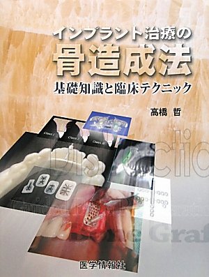 スマホ 無料電子書籍 インプラント治療の骨造成法―基礎知識と臨床テクニック バイ
