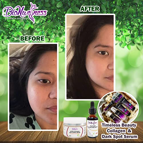 Bionwellness Dark Spot #TOP6