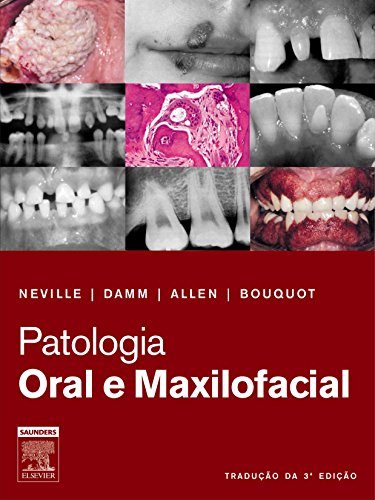Patologia Oral e Maxilofacial