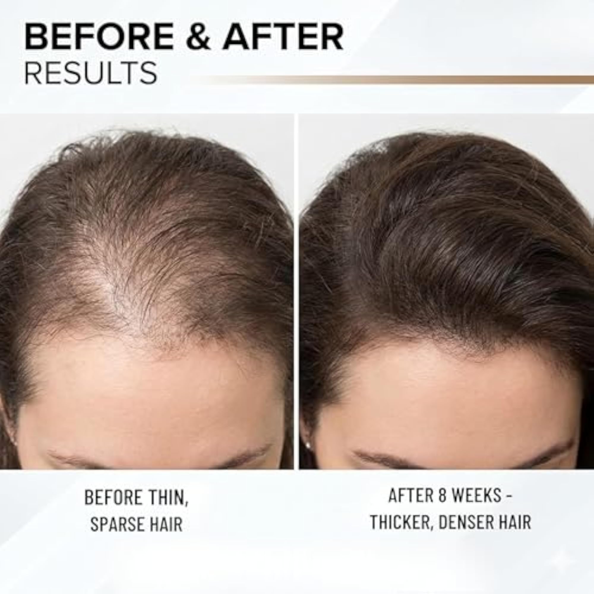 Advanced Hair Growth Serum Concentrate, Clinically Proven