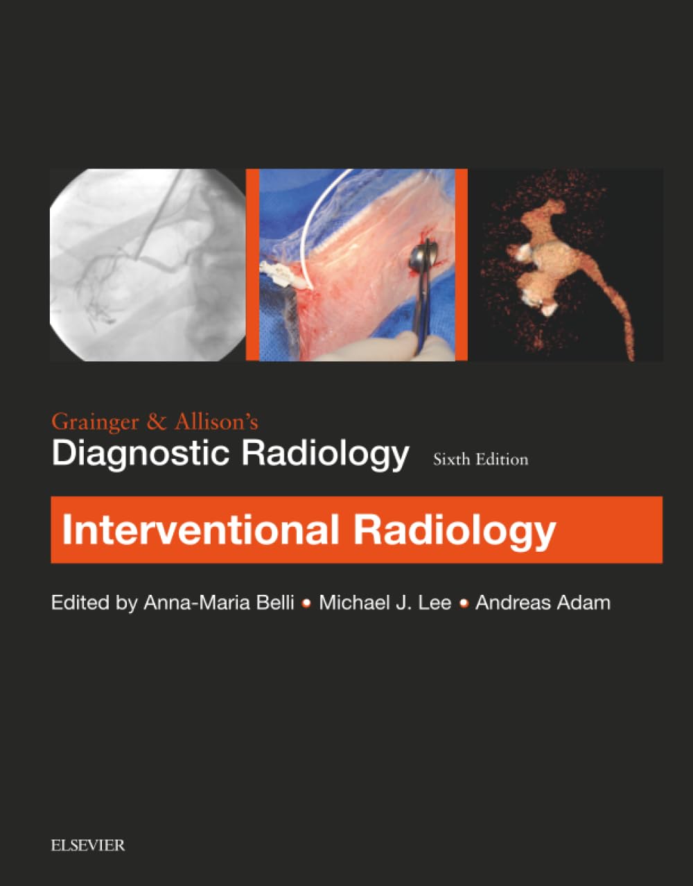 Grainger & Allison’s Diagnostic Radiology: Interventional Imaging