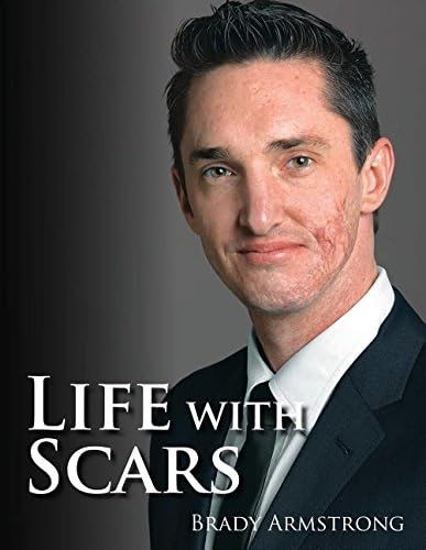 Life with Scars: A Guide to Emotionally Overcoming Physical Trauma