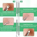 5PCS Blackhead Remover Comedone Extractor, Curved Blackhead Tweezers Kit, Professional Stainless Pimple Acne Blemish Removal Tools Kit for Manual - Image 5