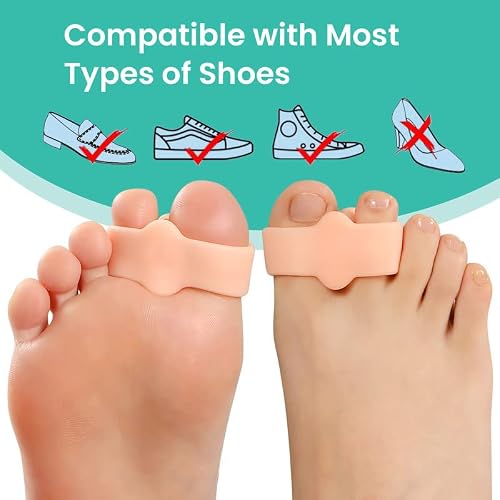 Welnove Pack Of 12 Bunion Corrector, Toe Separators With 2 Loops, Big Toe Spacer Suitable For Bunion And Overlapping Toe (Beige) #TOP5