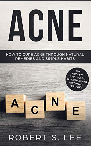 Acne: How to Cure Acne through Natural Remedies and Simple Habits. Say Goodbye
