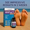 PURESKIN Plantar Wart Corn Remover for Feet: 17% Salicylic Acid Wart Corn Removal Treatment for Corn, Plantar Wart, Common Wart & Flat Wart on Toes, Fingers, feet and Hand - 0.5 Fl Oz (Pack of 1)