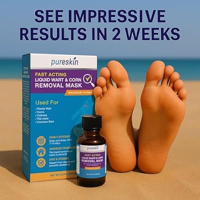 PURESKIN Plantar Wart Corn Remover for Feet: 17% Salicylic Acid Wart Corn Removal Treatment for Corn, Plantar Wart, Common Wart & Flat Wart on Toes, Fingers, feet and Hand - 0.5 Fl Oz (Pack of 1)