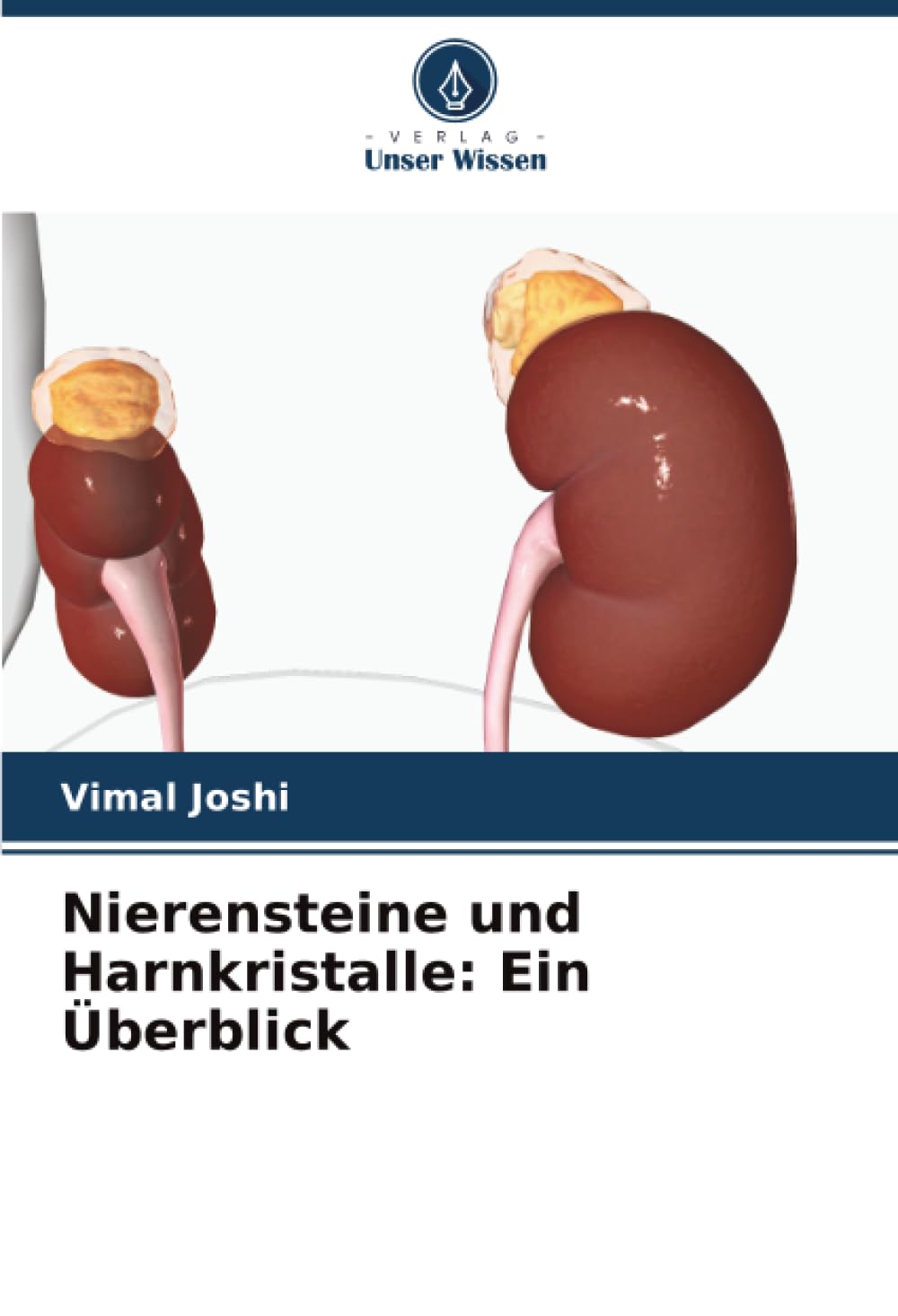 Nierensteine und Harnkristalle: Ein Überblick