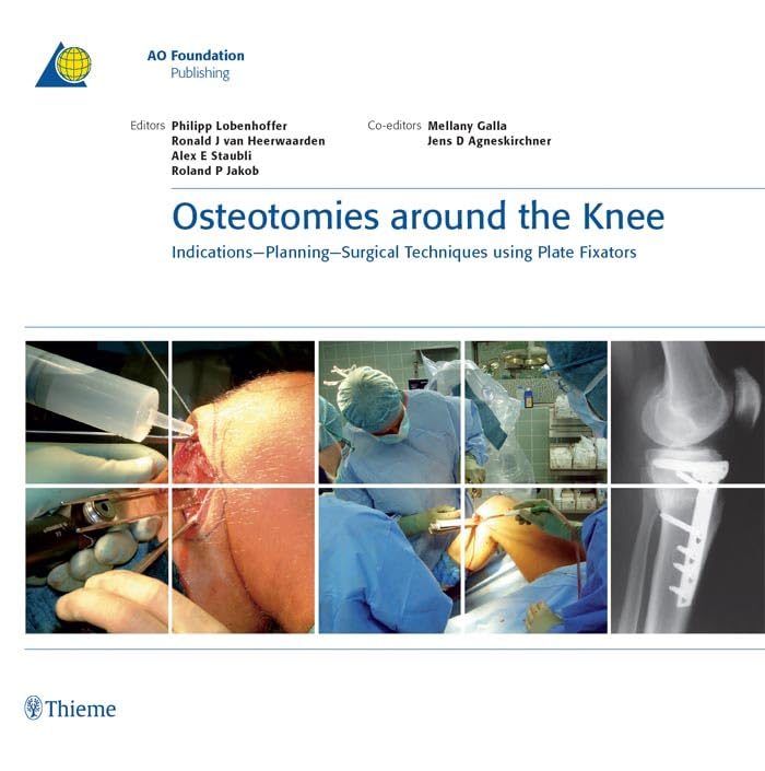 Osteotomies around the Knee: Indications - Planning - Surgical Techniques using Plate Fixators (AO-Publishing)