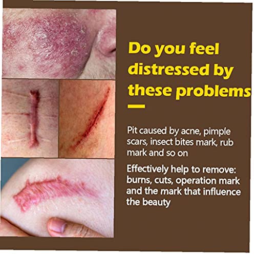 Littekenverwijdering Cream Acne Markeringen Remover Gel Skin Reparatie Burns Acne Spots Behandeling Optimale Restauratie… - Image 7