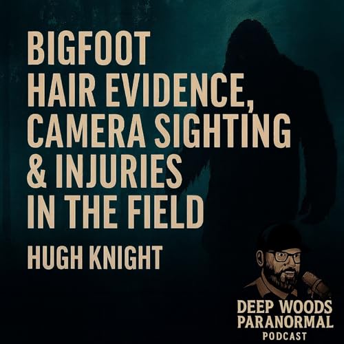 『Bigfoot Hair Evidence, Camera Sighting & Injuries in the Field | Hugh Knight of NW Yeti Quest』のカバーアート