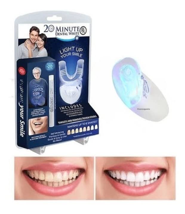 Cannagenix Tooth Polisher Cleaner Whitener and Tooth Stain Remover Whitening Kit for Good Smile (White) (B09T78D4ZS) Amazon Price History, Amazon Price Tracker