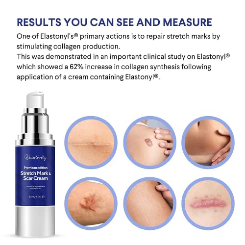 Stretch Mark Cream, Scar Cream Gel, Help With Stretch Marks, Scars From C- Sections, Surgery, Injury, And Burns, Made In Canada #TOP3