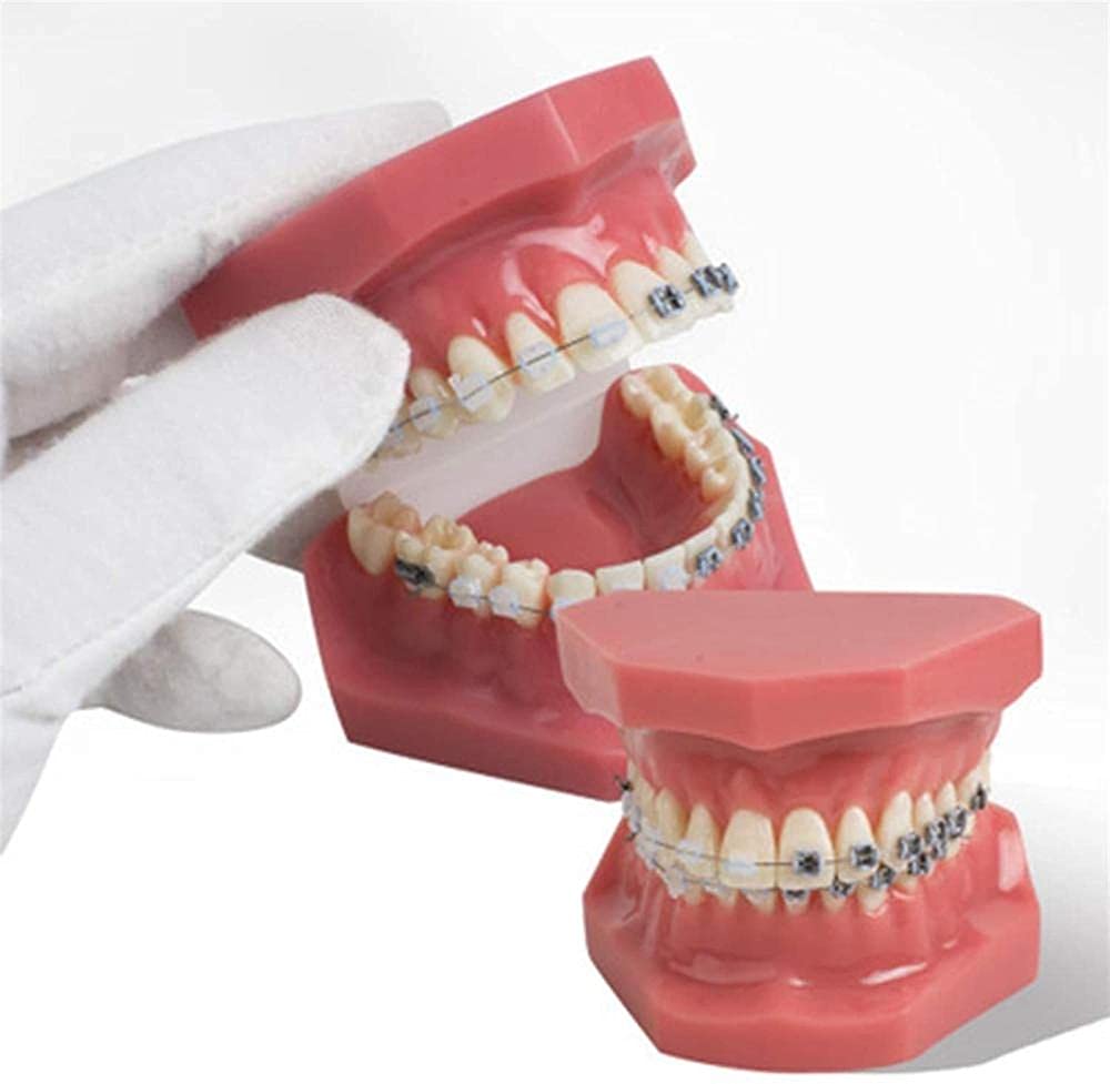 NaoSIn-Ni Model do nauki model zębów dentystyczne malokluzja ortodontyczne leczenie l nauka zębów do nauki 1 szt. medyczne narzędzie do nauki zabawka