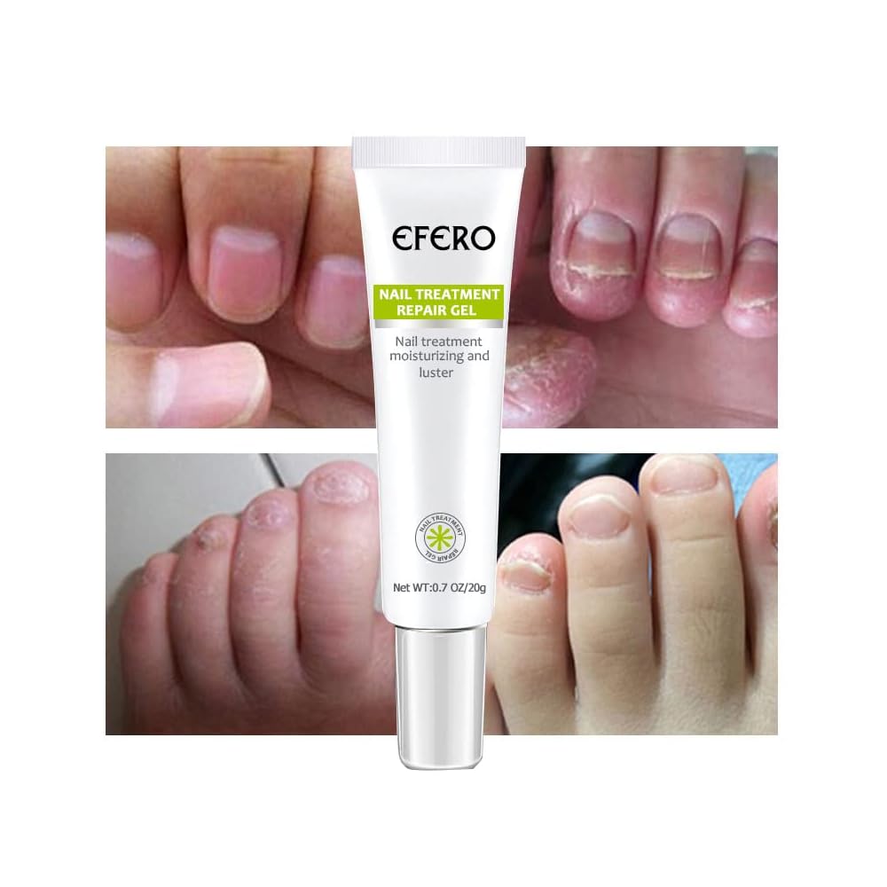 Efero Nail Treatment Repair Gel Restores Discolored or Damaged Nails