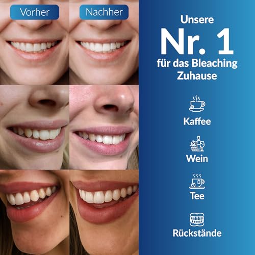 Perl Weiss Bleaching System 4.0 Kit Per Lo Sbiancamento Dei Denti 4 Pz - 5