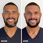 Hair & Beard Color for Full Gray Coverage 2 pack - Medium Brown - Ammonia-Free Complete Men’s At-home Beard & Hair Dye Kit, Professional-grade Permanent Hair Color (5.0) - Image 5