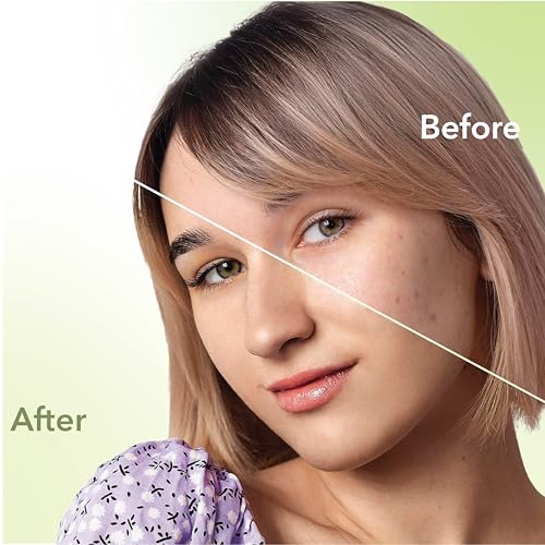 Image of DR.RASHEL Neem Acne Pimple Patch with Salicylic Acid, Hydrocolloid Patches for Zits and Blemishes, 36 Patches