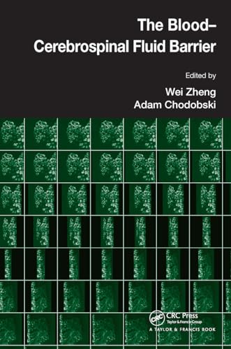 The Blood-Cerebrospinal Fluid Barrier