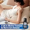 Extra Strength Wart Remover Liquid with 17% Salicylic Acid, Fast Acting Treatment for Plantar & Common Warts, Corn Remover for Feet and Toes (15ml, Warts Remover (1 P))