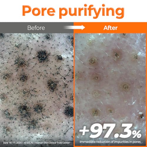 signiq Peptide Pore Renew Pad, Pore Purifying and Firming, Peptide, 0.2% BHA, Mini-Embossed Toner Pads for Glass Skin, Korean Skincare (70 Pads, 160ml, 5.41 fl.oz.) — view 4