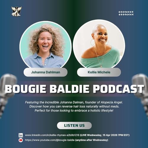 Hair Loss Journey & Holistic Healing | My Story on Bougie Baldie Podcast (Part 1)