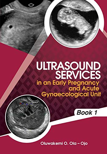Ultrasound Services in An Early Pregnancy and Acute Gynaecological Unit (BOOK1)